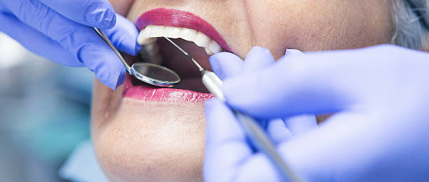 Best Emergency Root Canal Treatment in Beaufort, NC